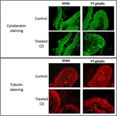 Coeliac Disease Pathogenesis: The Uncertainties of a Well-Known Immune Mediated Disorder